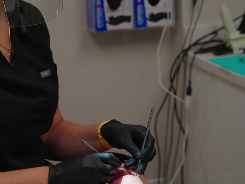 Dental Implants